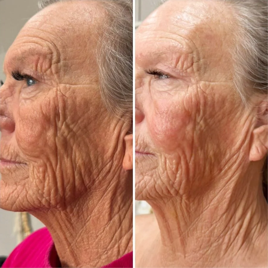 plx-ba-neck