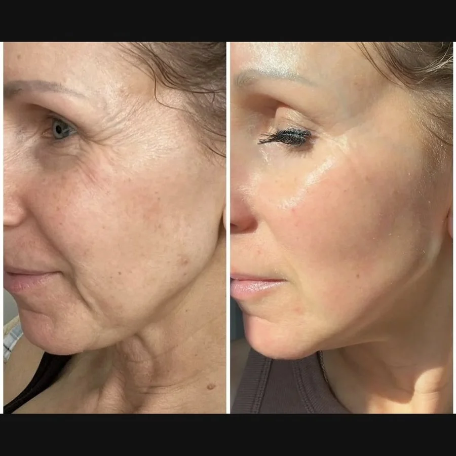 plx-ba-profile